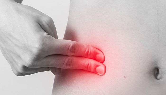 Các dấu hiệu đau ruột thừa - viêm ruột thừa dễ nhận biết